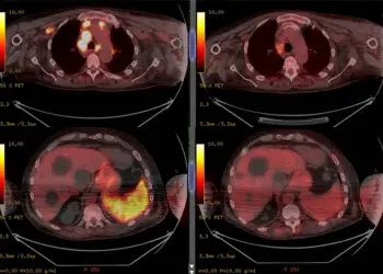 Imagem ilustrativa (Reprodução/British Journal of Haematology
)