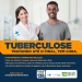 tuberculose