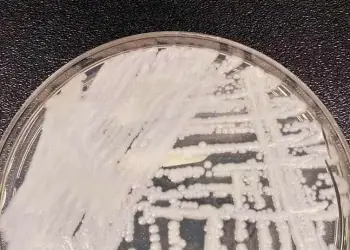 superfungo candida auris