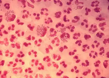 Bactéria 'Neisseria gonorrhoeae', causadora da gonorreia, infecção sexualmente transmissível (CDC/ Joe Millar)