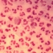 Bactéria 'Neisseria gonorrhoeae', causadora da gonorreia, infecção sexualmente transmissível (CDC/ Joe Millar)