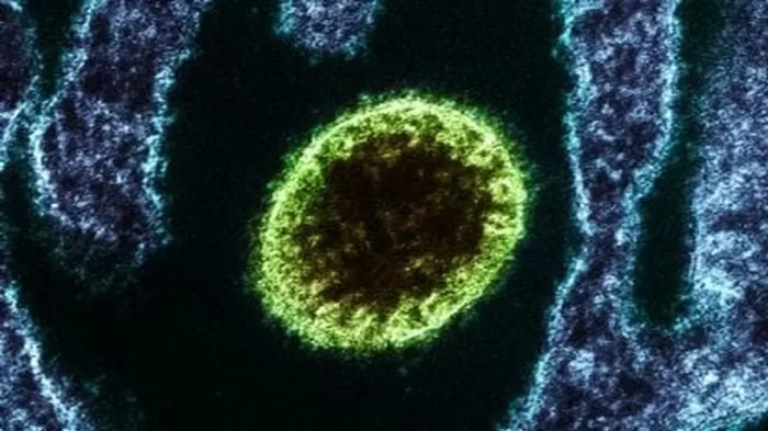 virus nipah