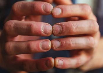 homem mostrando as unhas