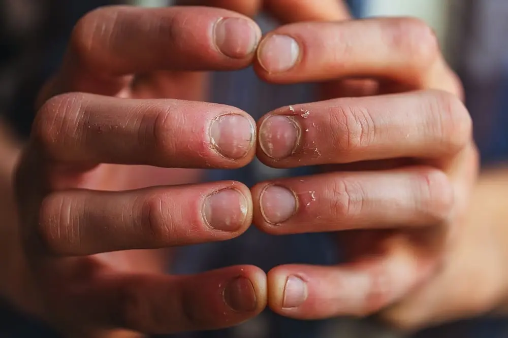 homem mostrando as unhas